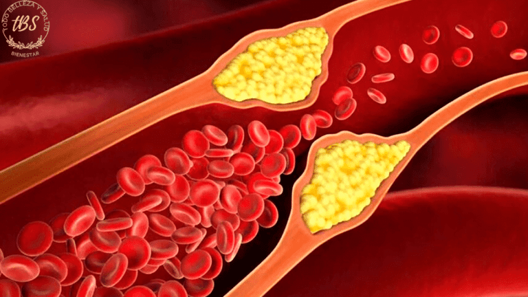 Colesterol Alto Una Enfermedad Silenciosa