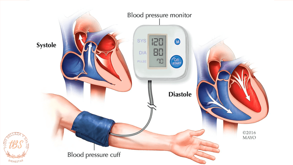 Que es la Hipertensión