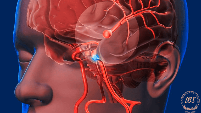 ¿Qué es un accidente cerebrovascular (ACV)?