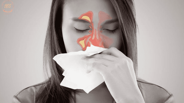 Todo sobre la Sinusitis