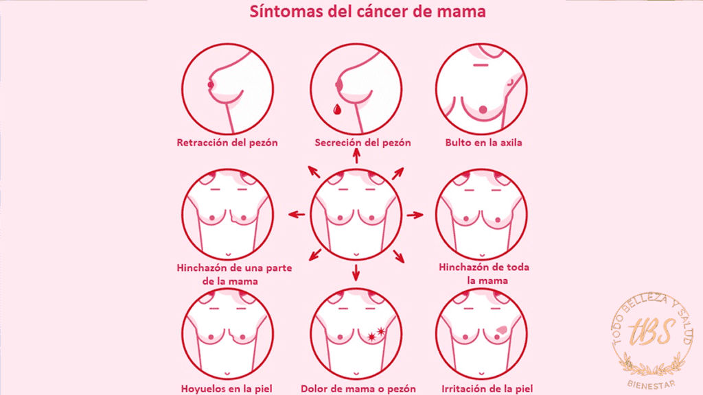 Cáncer de Seno