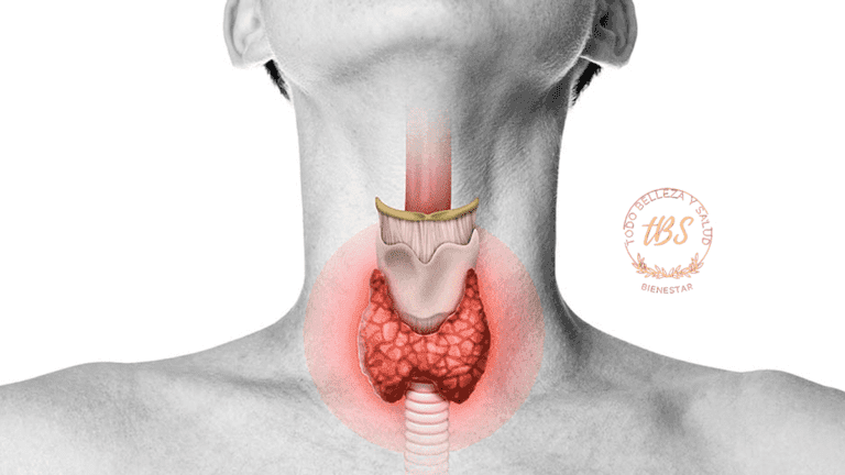 Qué es el Hipotiroidismo
