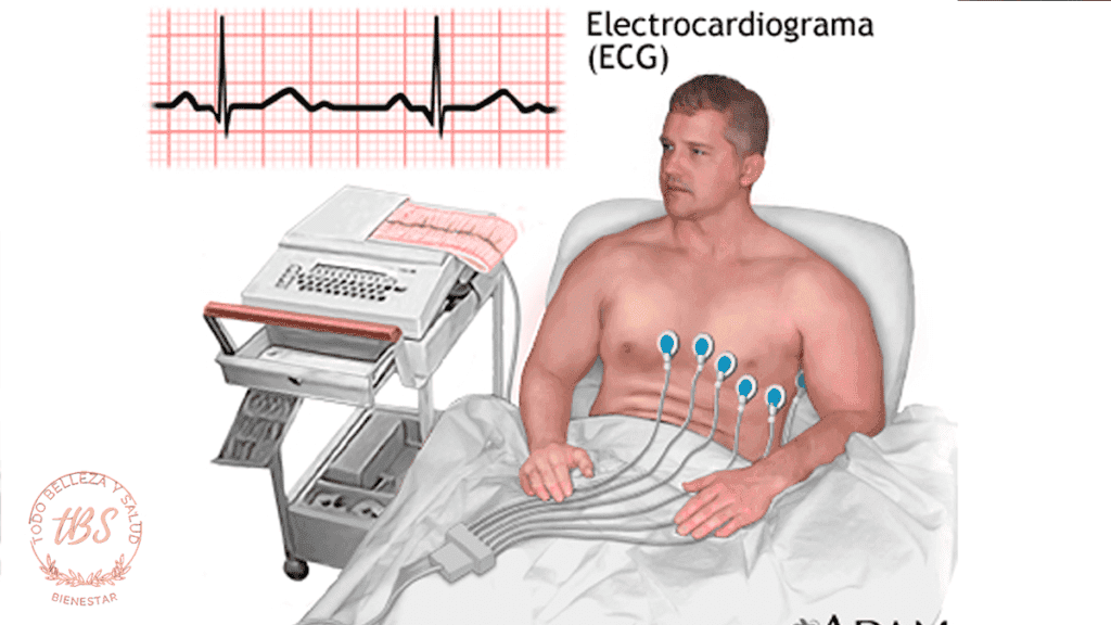 Qué es un electrocardiograma