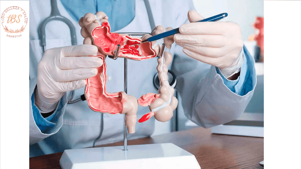 Síndrome del Intestino Irritable (SII)