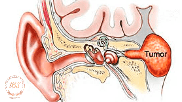 dibujo Cáncer de oído